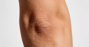 What is the skin on your elbow called? The Science Behind Your Wenis