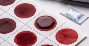Dried blood spot testing: A simple and accurate way to monitor your health