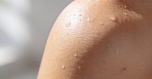 How to stop peeling skin: Effective tips for healthy, hydrated results