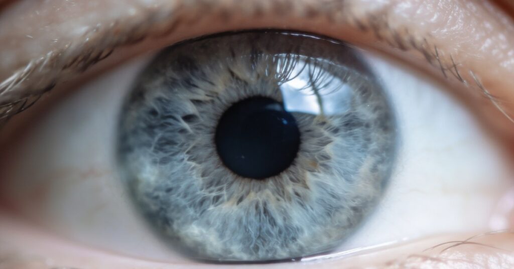 Bloodshot in eyes: Common causes and when to see a doctor