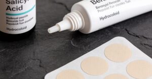 What is pimples? Understanding Causes and Effective Treatment Options