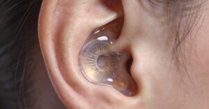 Otitis media with effusion: Symptoms, Causes, and Effective Treatments
