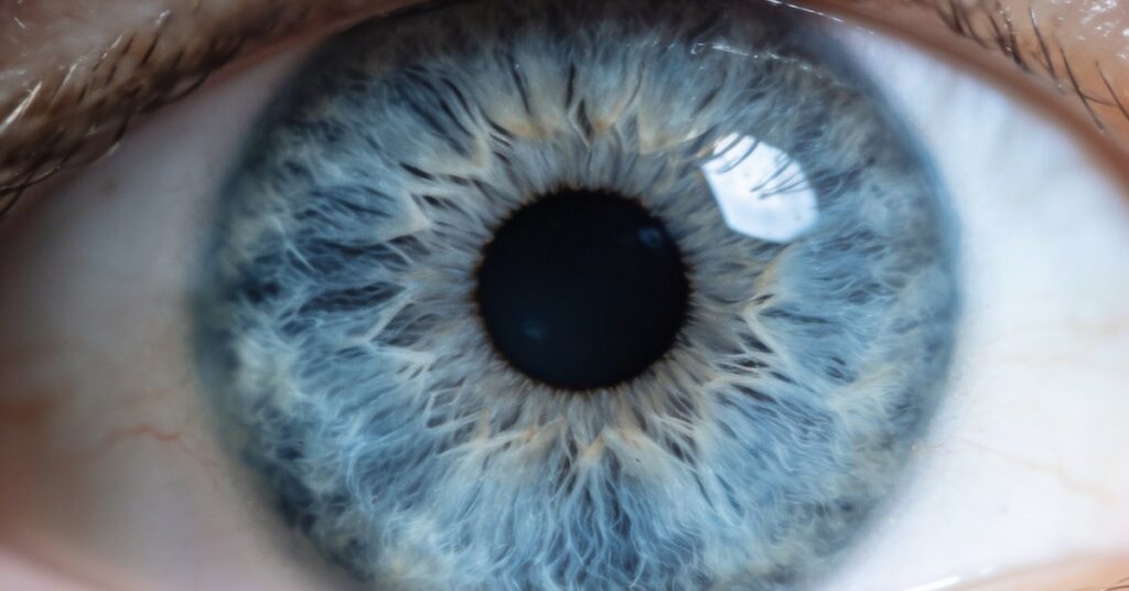 Stress rings in eyes: What they are and how to manage them